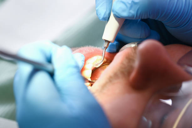 Best Urgent Dental Care for Toothache in Edwardsvle, IL