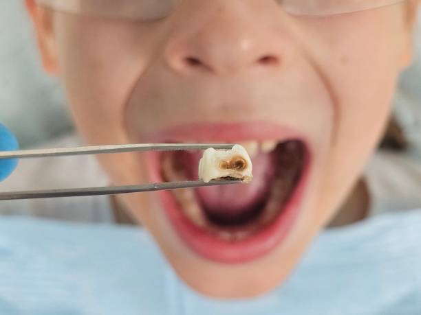 Best Pediatric Emergency Dentist in Edwardsvle, IL